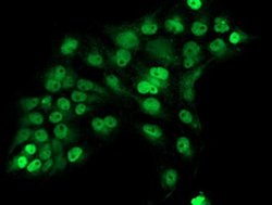 ERCC1 Monoclonal Antibody (OTI1C10), TrueMAB , OriGene 100 &mu;L; Unconjugated:Antibodies,