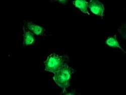ERCC1 Monoclonal Antibody (OTI3B1), TrueMAB , OriGene:Antibodies:Primary