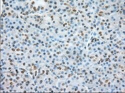ERCC1 Monoclonal Antibody (OTI1B3), TrueMAB , OriGene 30 &mu;L; Unconjugated:Antibodies,