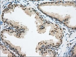 ERCC1 Monoclonal Antibody (OTI1B3), TrueMAB , OriGene 30 &mu;L; Unconjugated:Antibodies,