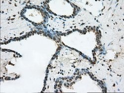 ERCC1 Monoclonal Antibody (OTI1B3), TrueMAB , OriGene 30 &mu;L; Unconjugated:Antibodies,