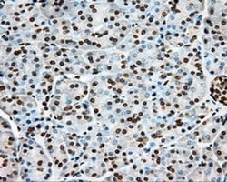 ERCC1 Monoclonal Antibody (OTI3F2), TrueMAB , OriGene 30 &mu;L; Unconjugated:Antibodies,