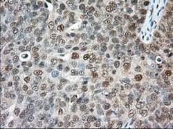 ERCC1 Monoclonal Antibody (OTI1C6), TrueMAB , OriGene 100 &mu;L; Unconjugated:Antibodies,