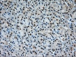 ERCC1 Monoclonal Antibody (OTI1C6), TrueMAB , OriGene 100 &mu;L; Unconjugated:Antibodies,