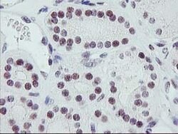 ERCC1 Monoclonal Antibody (OTI1C6), TrueMAB , OriGene 100 &mu;L; Unconjugated:Antibodies,