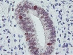 ERCC1 Monoclonal Antibody (OTI1C6), TrueMAB , OriGene 100 &mu;L; Unconjugated:Antibodies,