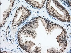 ERCC1 Monoclonal Antibody (OTI1C6), TrueMAB , OriGene 100 &mu;L; Unconjugated:Antibodies,