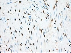 ERCC1 Monoclonal Antibody (OTI1C6), TrueMAB , OriGene 100 &mu;L; Unconjugated:Antibodies,