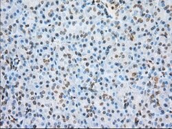 ERCC1 Mouse anti-Human, Clone: OTI2A7, lyophilized, TrueMAB 100 &mu;g;