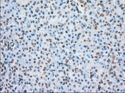 ERCC1 Monoclonal Antibody (OTI2A7), TrueMAB , OriGene 100 &mu;L; Unconjugated:Antibodies,
