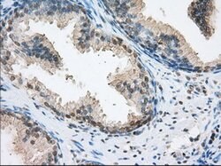 ERCC1 Mouse anti-Human, Clone: OTI2A7, lyophilized, TrueMAB 100 &mu;g;