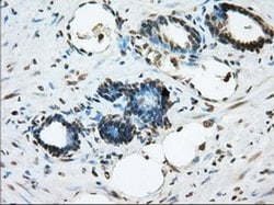 ERCC1 Monoclonal Antibody (OTI2A7), TrueMAB , OriGene 100 &mu;L; Unconjugated:Antibodies,