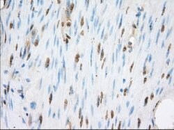 ERCC1 Mouse anti-Human, Clone: OTI2A7, lyophilized, TrueMAB 100 &mu;g;