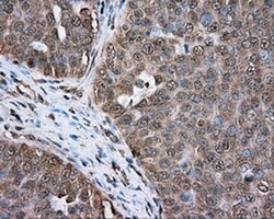 ERCC1 Monoclonal Antibody (OTI1G6), TrueMAB , OriGene 100 &mu;L; Unconjugated:Antibodies,