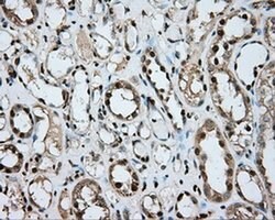 ERCC1 Monoclonal Antibody (OTI1G6), TrueMAB , OriGene 100 &mu;L; Unconjugated:Antibodies,