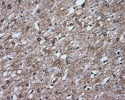 ERCC1 Monoclonal Antibody (OTI1G6), TrueMAB , OriGene 100 &mu;L; Unconjugated:Antibodies,