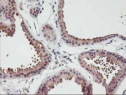 ERCC1 Monoclonal Antibody (OTI5A2), TrueMAB , OriGene 100 &mu;L | Buy Online | Origene Technologies | Fisher Scientific