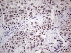 ERCC1 Mouse anti-Human, Clone: OTI2H1, lyophilized, TrueMAB 100 &mu;g;