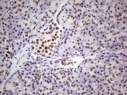 ERCC1 Mouse anti-Human, Clone: OTI2H1, lyophilized, TrueMAB 100 &mu;g;