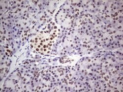 ERCC1 Monoclonal Antibody (OTI2H1), TrueMAB , OriGene 100 &mu;L; Unconjugated:Antibodies,