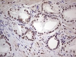 ERCC1 Mouse anti-Human, Clone: OTI2H1, lyophilized, TrueMAB 100 &mu;g;