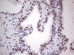 ERCC1 Mouse anti-Human, Clone: OTI2H1, lyophilized, TrueMAB 100 &mu;g;