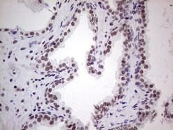 ERCC1 Monoclonal Antibody (OTI2H1), TrueMAB , OriGene 100 &mu;L; Unconjugated:Antibodies,
