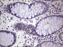 ERCC1 Mouse anti-Human, Clone: OTI2H1, lyophilized, TrueMAB 100 &mu;g;