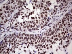 ERCC1 Mouse anti-Human, Clone: OTI2H1, lyophilized, TrueMAB 100 &mu;g;