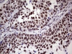 ERCC1 Monoclonal Antibody (OTI2H1), TrueMAB , OriGene 100 &mu;L; Unconjugated:Antibodies,
