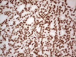 ERCC1 Monoclonal Antibody (OTI2B4), TrueMAB , OriGene 100 &mu;L; Unconjugated:Antibodies,