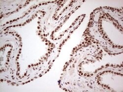 ERCC1 Monoclonal Antibody (OTI2B4), TrueMAB , OriGene 100 &mu;L; Unconjugated:Antibodies,