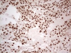 ERCC1 Monoclonal Antibody (OTI2B4), TrueMAB , OriGene 100 &mu;L; Unconjugated:Antibodies,