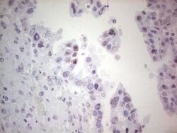 ERCC1 Monoclonal Antibody (OTI2B4), TrueMAB , OriGene 100 &mu;L; Unconjugated:Antibodies,