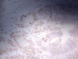 ERCC1 Monoclonal Antibody (OTI6H7), TrueMAB , OriGene:Antibodies:Primary