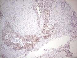 ERCC1 Monoclonal Antibody (OTI6H7), TrueMAB , OriGene 100 &mu;L; Unconjugated:Antibodies,