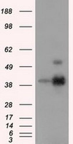 ERCC1 Monoclonal Antibody (OTI1B3), TrueMAB , OriGene 30 &mu;L; Unconjugated:Antibodies,