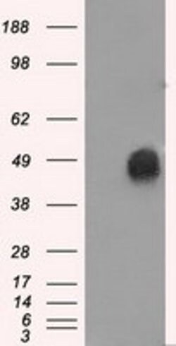 ERCC1 Mouse anti-Human, Clone: OTI3F2, lyophilized, TrueMAB 100 &mu;g;