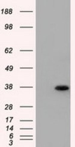 ERCC1 Mouse anti-Human, Clone: OTI2A7, lyophilized, TrueMAB 100 &mu;g;