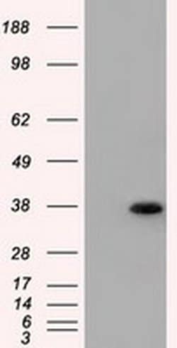 ERCC1 Monoclonal Antibody (OTI2A7), TrueMAB , OriGene:Antibodies:Primary