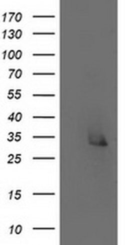 ERCC1 Monoclonal Antibody (OTI1H1), TrueMAB , OriGene 30 &mu;L; Unconjugated:Antibodies,