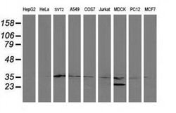 ERCC1 Monoclonal Antibody (OTI1H1), TrueMAB , OriGene 30 &mu;L; Unconjugated:Antibodies,