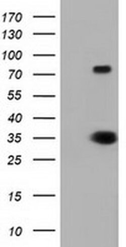 ERCC1 Monoclonal Antibody (OTI1A8), TrueMAB , OriGene:Antibodies:Primary