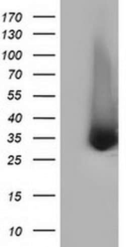 ERCC1 Monoclonal Antibody (OTI3G5), TrueMAB , OriGene 100 &mu;L; Unconjugated:Antibodies,
