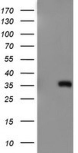 ERCC1 Mouse anti-Human, Clone: OTI2A8, lyophilized, TrueMAB 100 &mu;g;