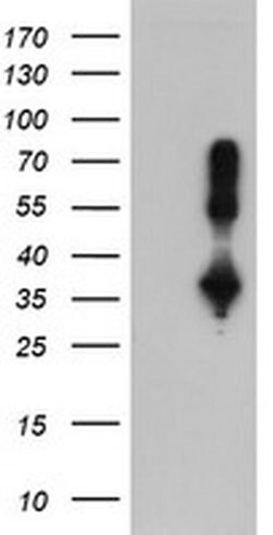 ERCC1 Monoclonal Antibody (OTI12F11), TrueMAB , OriGene 100 &mu;L; Unconjugated:Antibodies,