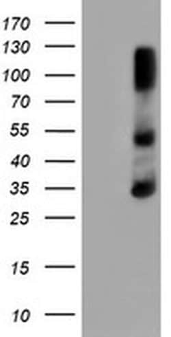 ERCC1 Monoclonal Antibody (OTI1C10), TrueMAB , OriGene 100 &mu;L; Unconjugated:Antibodies,
