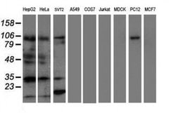 ERCC1 Monoclonal Antibody (OTI1C10), TrueMAB , OriGene 100 &mu;L; Unconjugated:Antibodies,