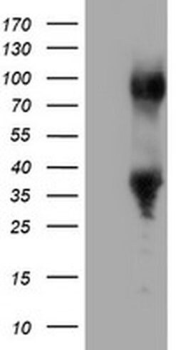 ERCC1 Monoclonal Antibody (OTI3B1), TrueMAB , OriGene:Antibodies:Primary