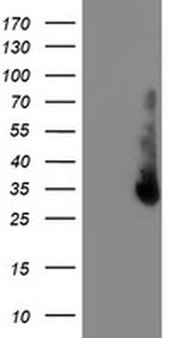 ERCC1 Monoclonal Antibody (OTI5A2), TrueMAB , OriGene 100 &mu;L | Buy Online | Origene Technologies | Fisher Scientific